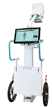 Mobile radiography systems 