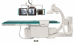 X-ray angiography systems 