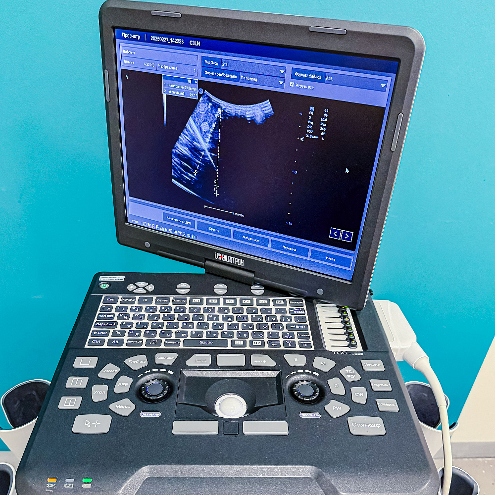 НИПК «Электрон» начала производство портативных УЗИ-систем